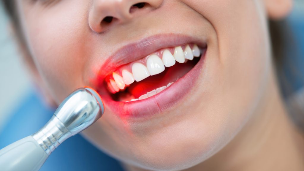 gualtieri dentiste laser04