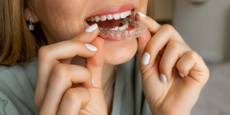 gualtieri dentiste orthodontie invisible