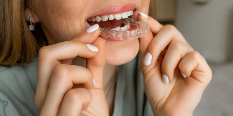 gualtieri dentiste orthodontie invisible