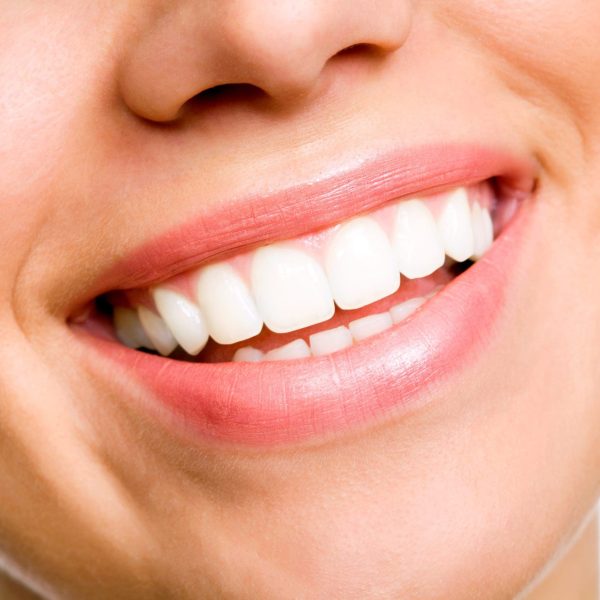 sourire parfait